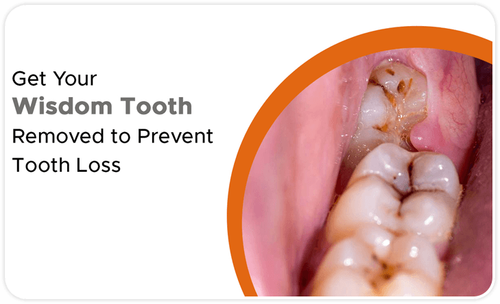 Dental Clip Treatment In Hyderabad 2