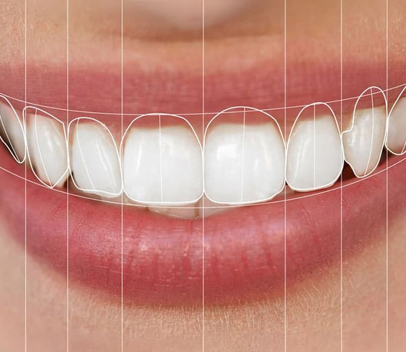 Advanced dental laser equipment