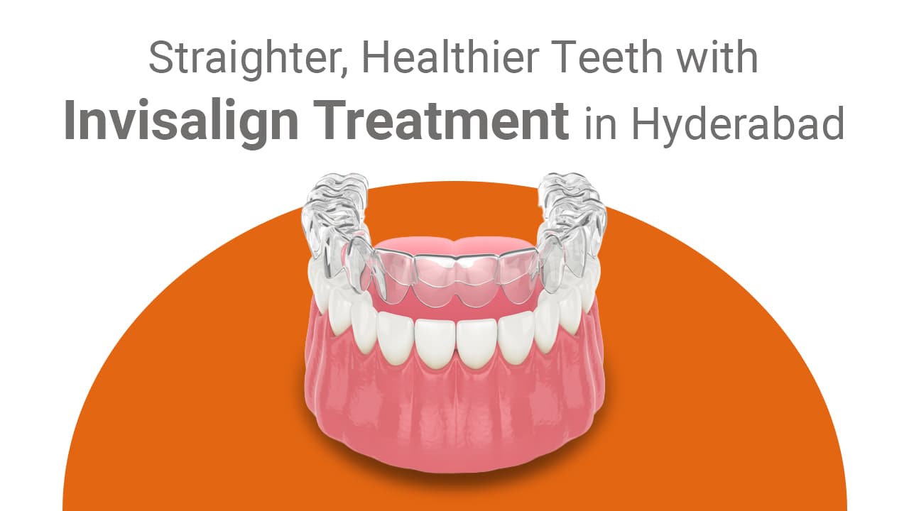 Benefits Of Invisalign Straighter And Healthier Teeth