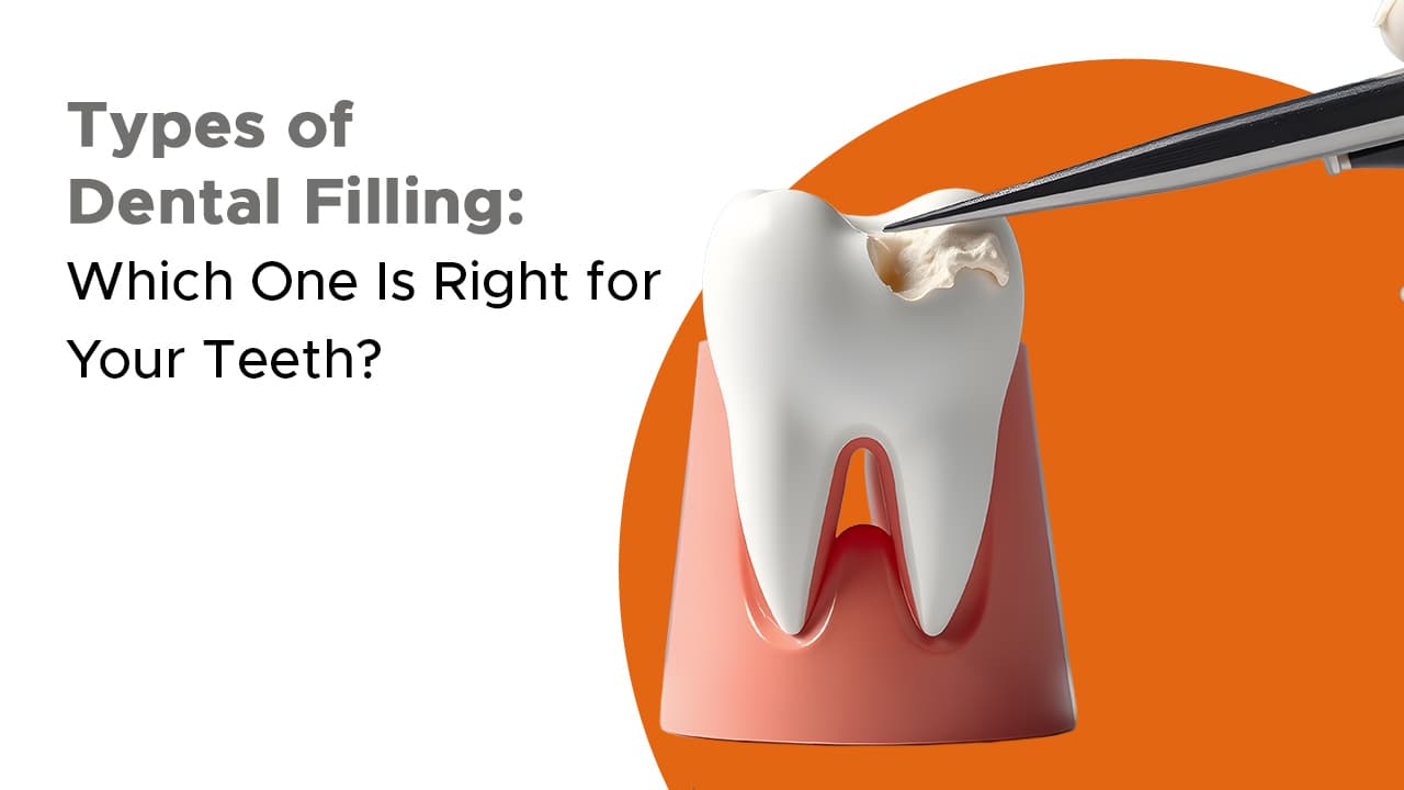 Types Of Dental Filling Which One Is Right For Your Teeth
