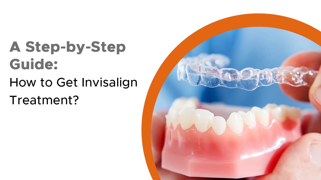 A Step By Step Guide How To Get Invisalign Treatment