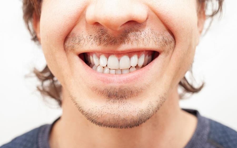 After