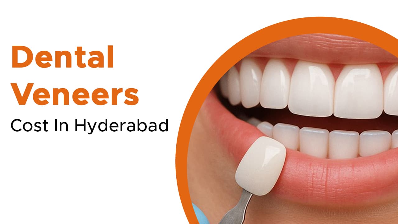 Dental Veneers Cost In Hyderabad