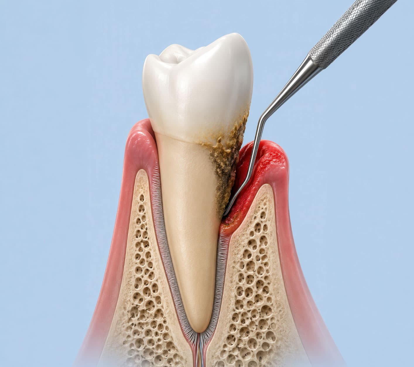 dental-calculus-cost-in-hyderabad