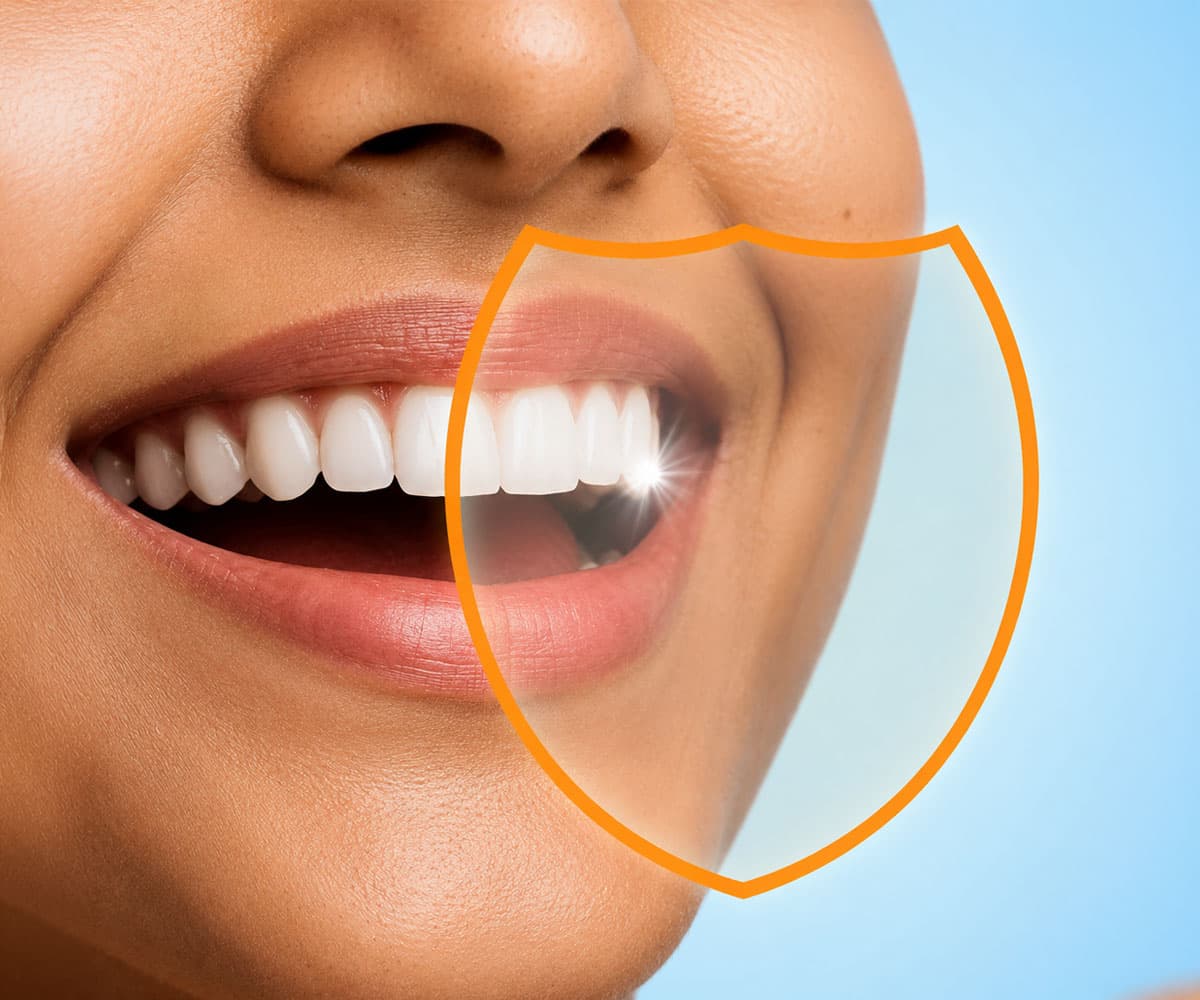 dental-fluorosis-treatment-cost