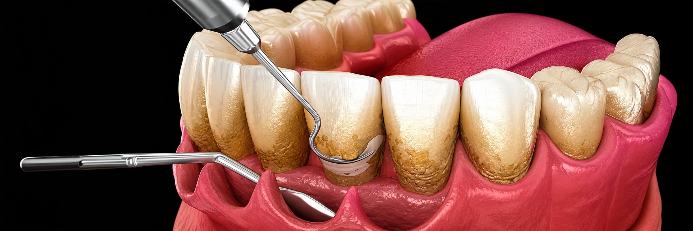 flap-surgery-in-hyderabad