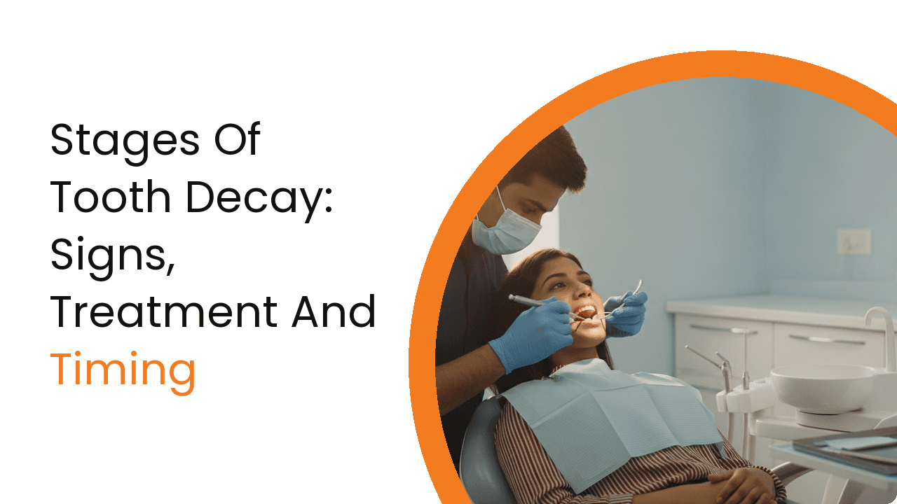 Stages Of Tooth Decay