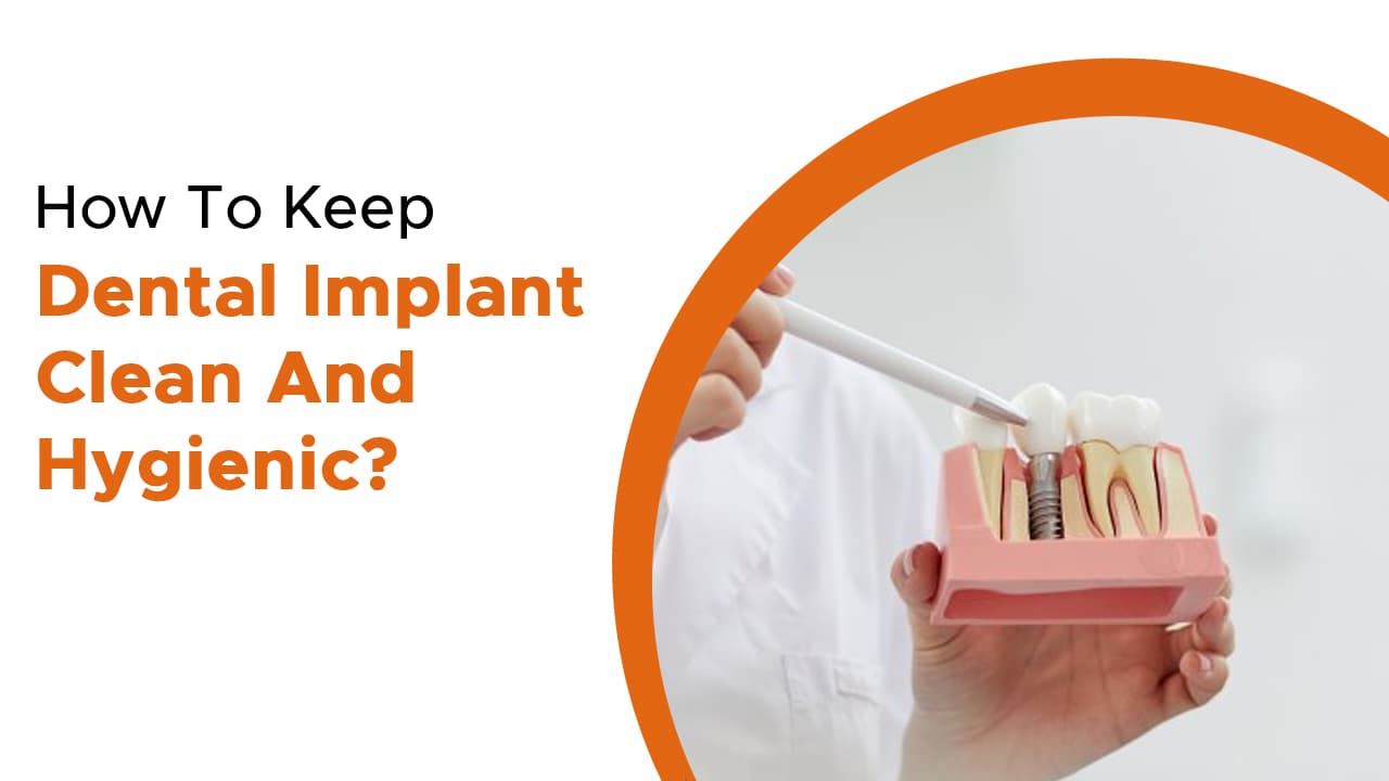How To Keep Dental Implant Clean And Hygienic?