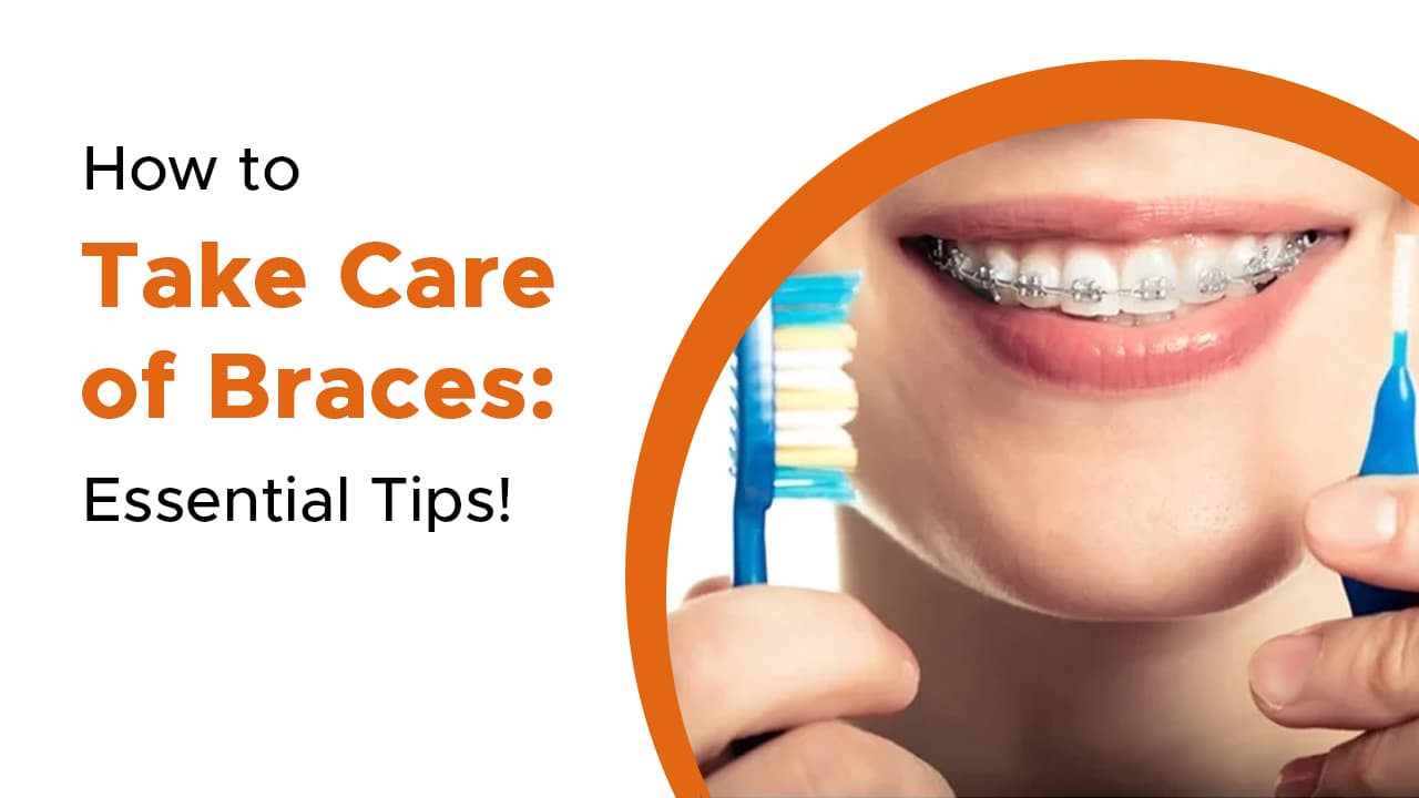How To Take Care Of Braces Essential Tips
