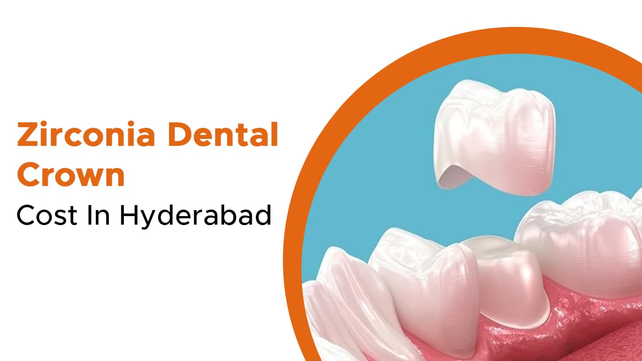 Zirconia Dental Crown Cost In Hyderabad