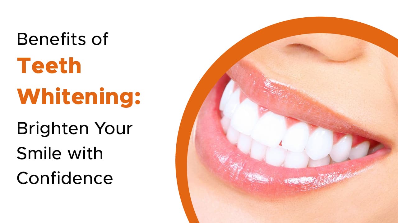 Benefits of Teeth Whitening: Brighten Your Smile with Confidence