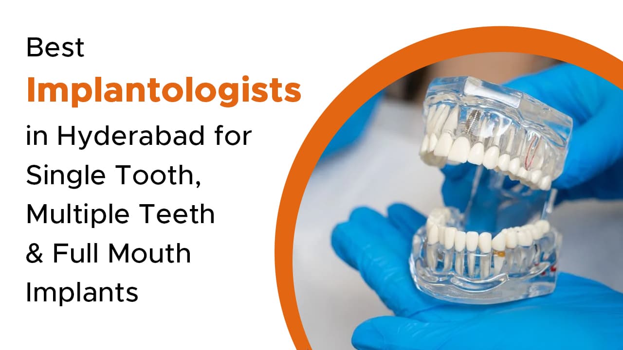 Best Implantologists in Hyderabad for Single , Multiple & Full Mouth Implants