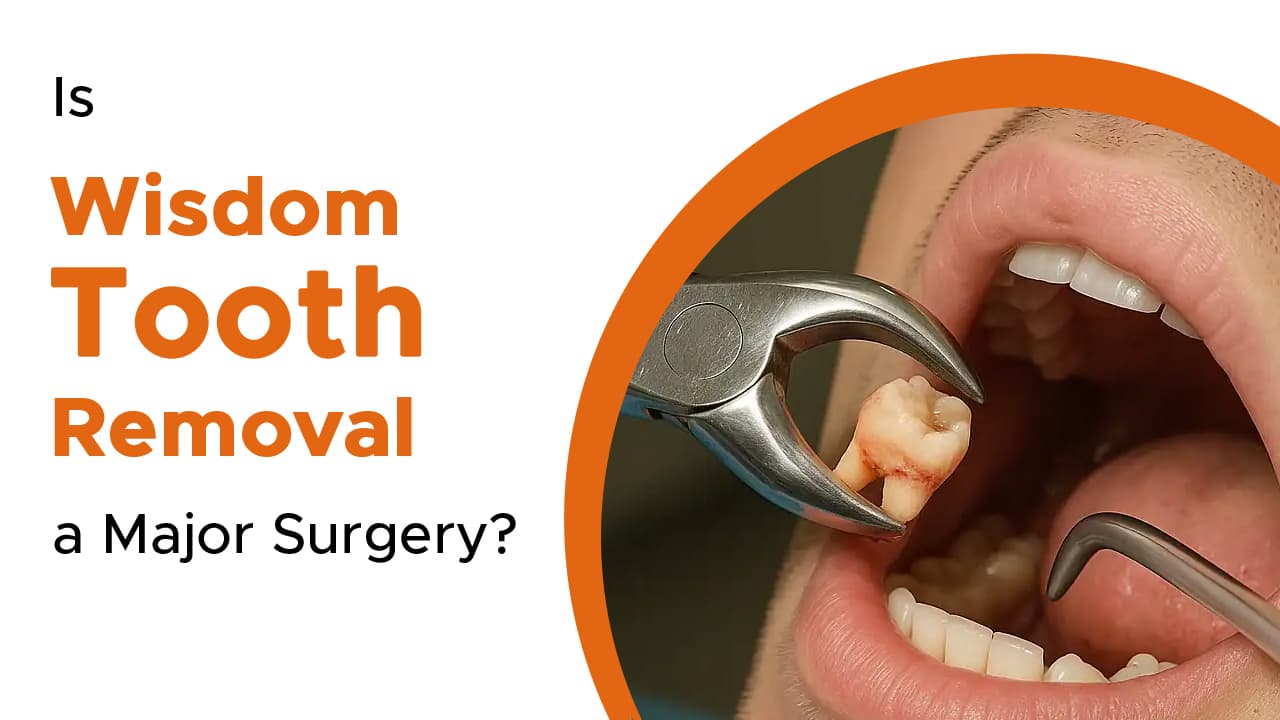 Is Wisdom Tooth Removal a Major Surgery?