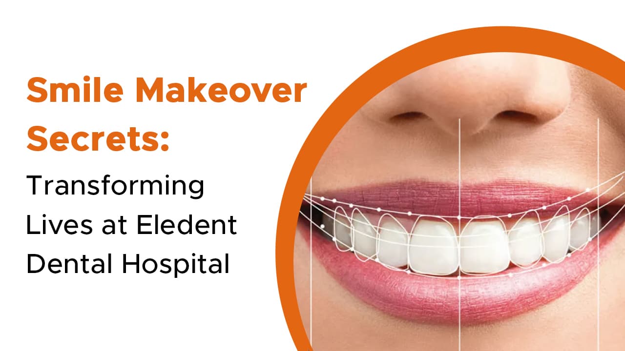 Smile Makeover Secrets: Transforming Lives at Eledent Dental Hospital