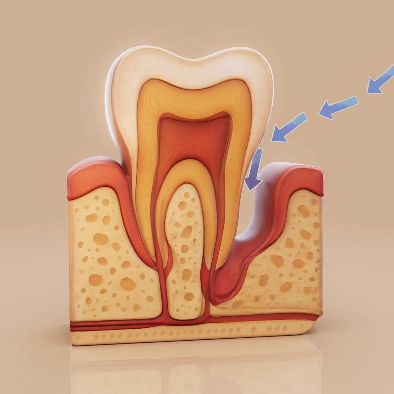 dental-abscess-treatment-cost-in-hyderabad