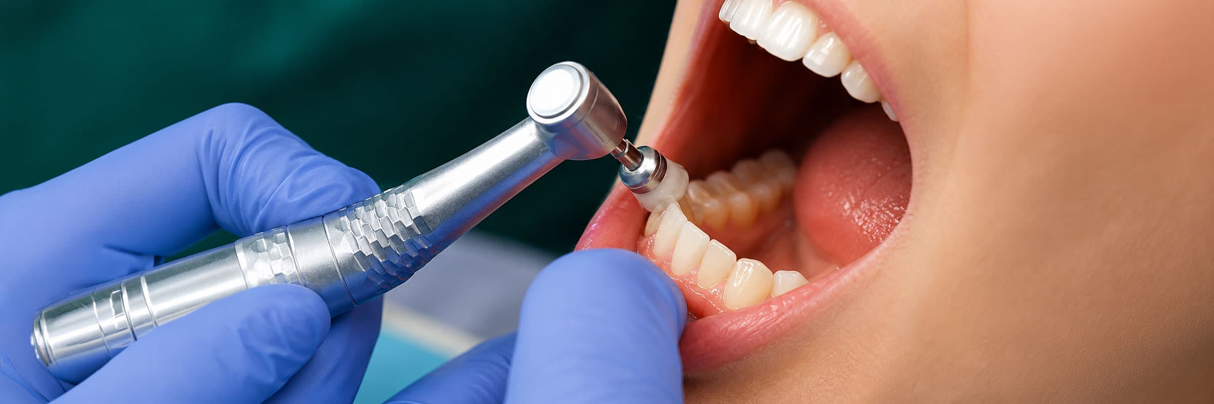 FMOP-Treatment
