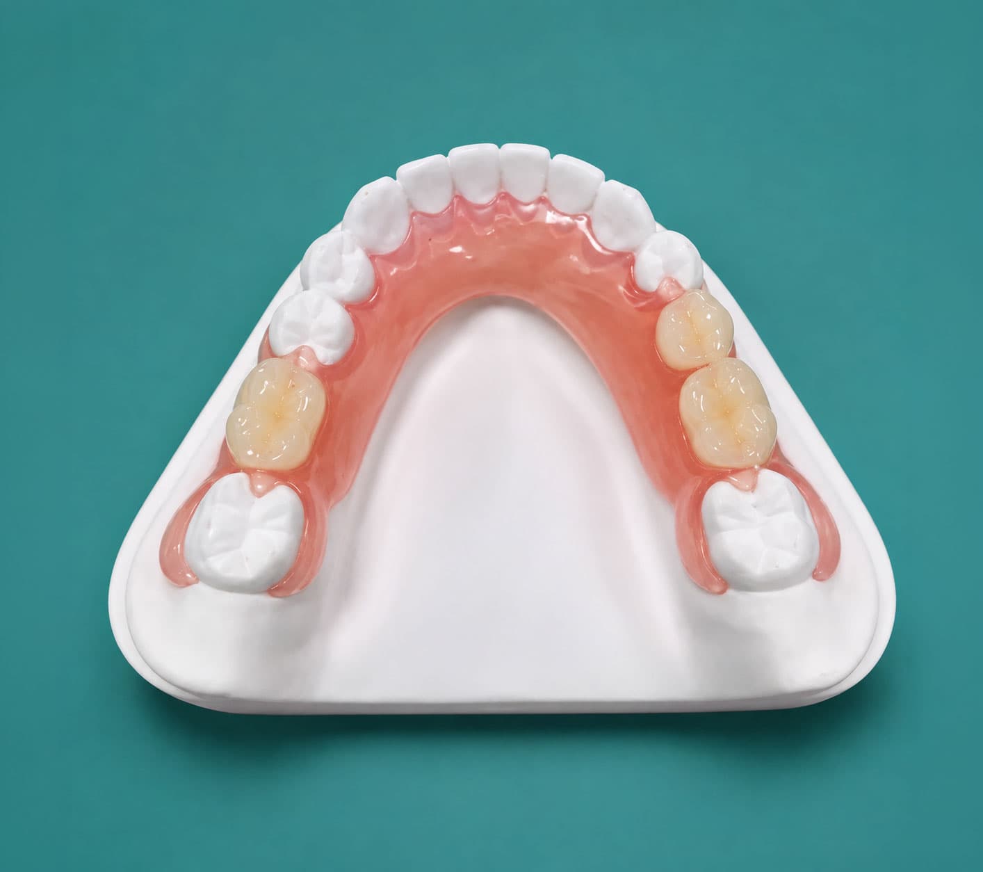 flexi-denture-treatment-cost-in-hyderabad