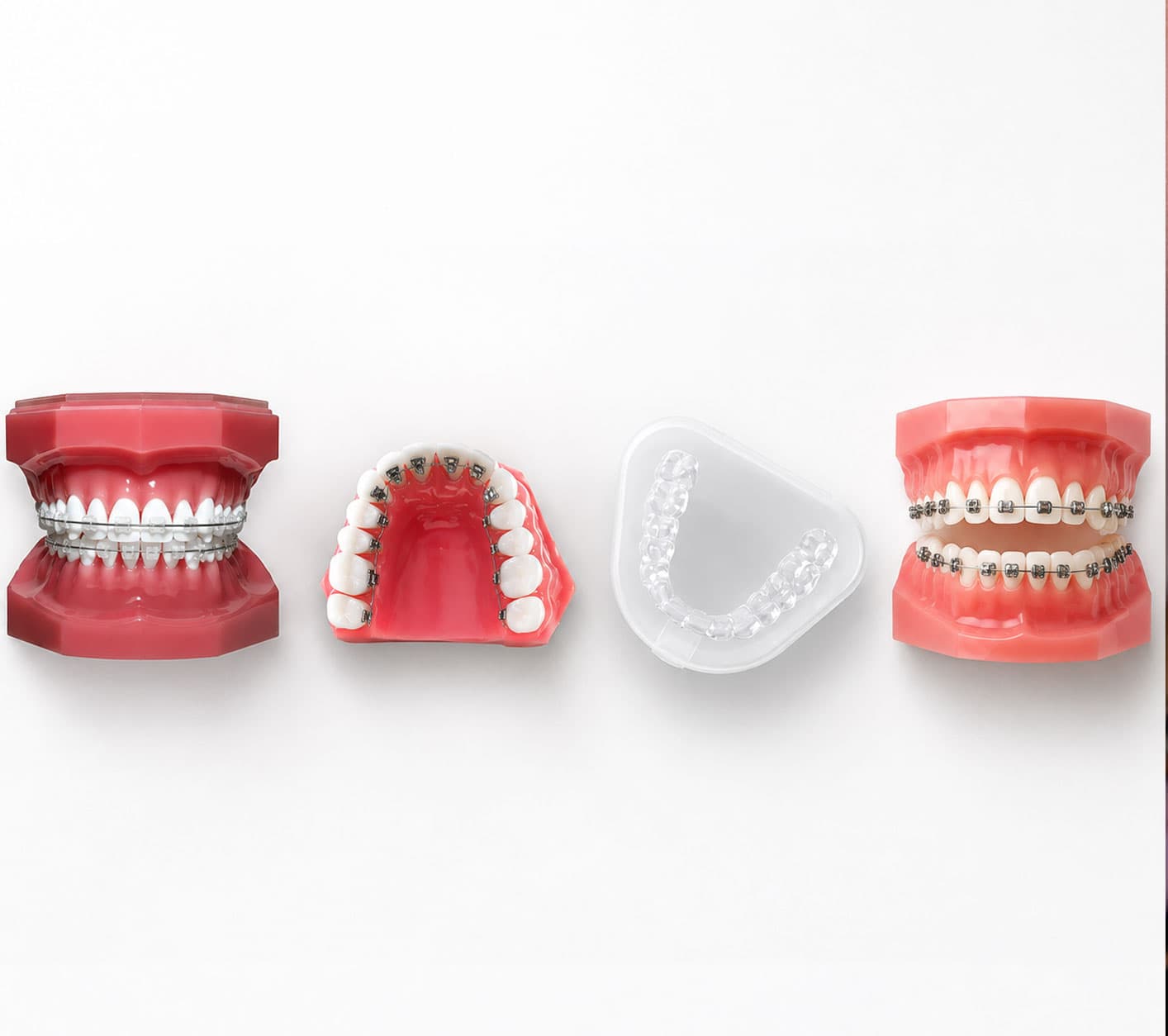 types-of-dental-clip-treatment-at-eledent