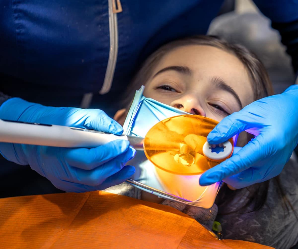 types-of-dental-fluorosis-treatment-at-eledent