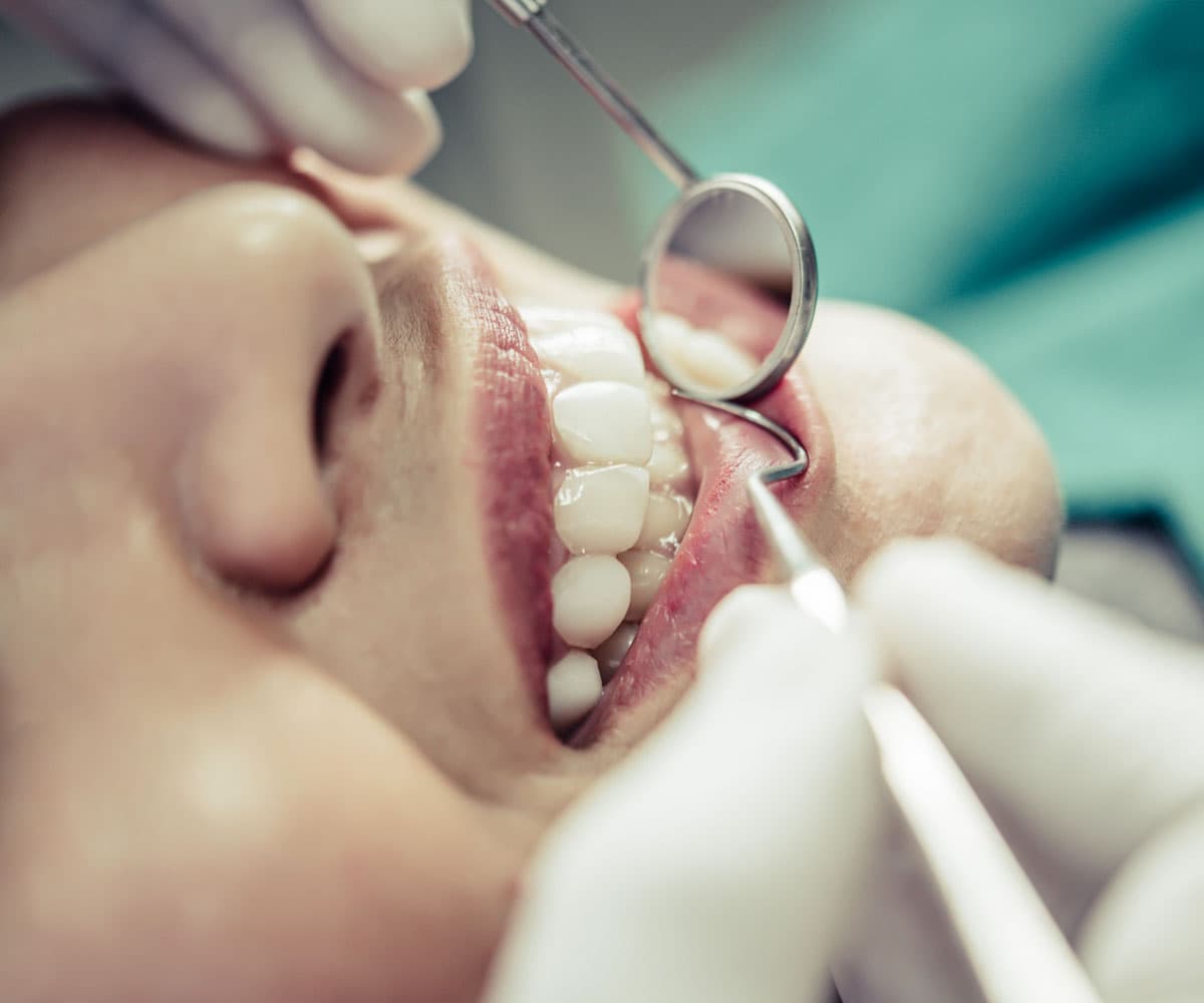 what-to-expect-during-dental-cap-treatment