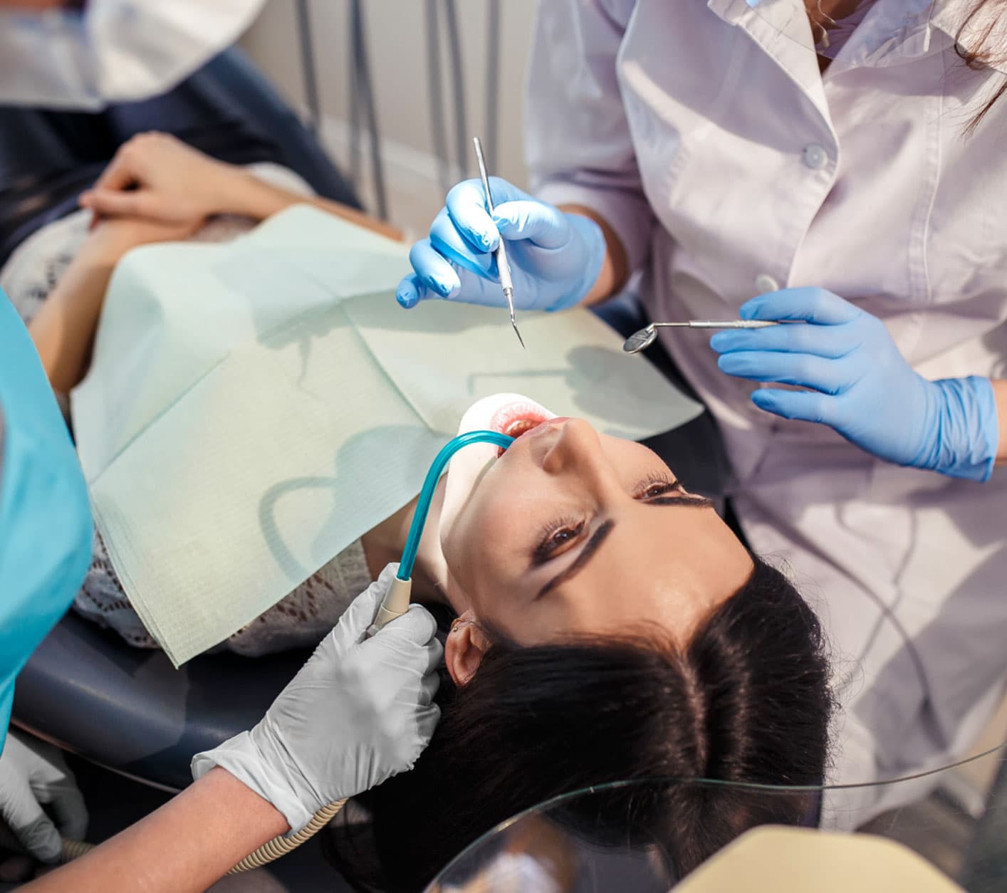 your-dental-calculus-process-at-eledent-hyderabad