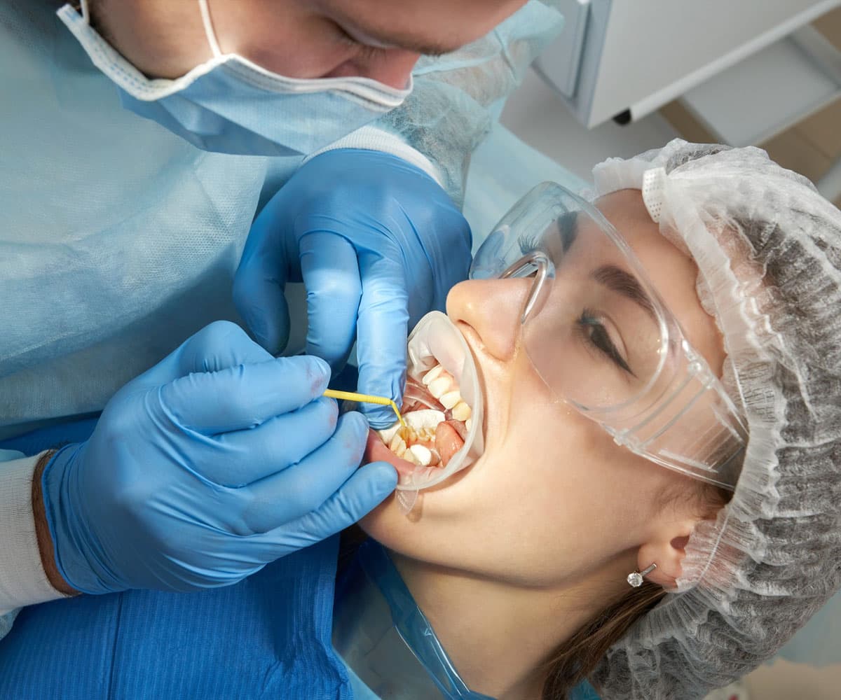 your-dental-cap-treatment-process-at-eledent-hyderabad