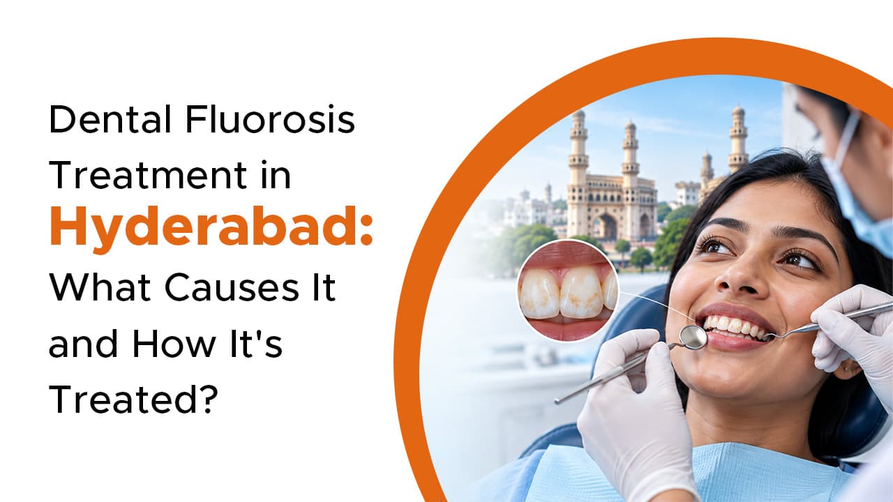 Dental Fluorosis Treatment In Hyderabad What Causes It And How Its Treated