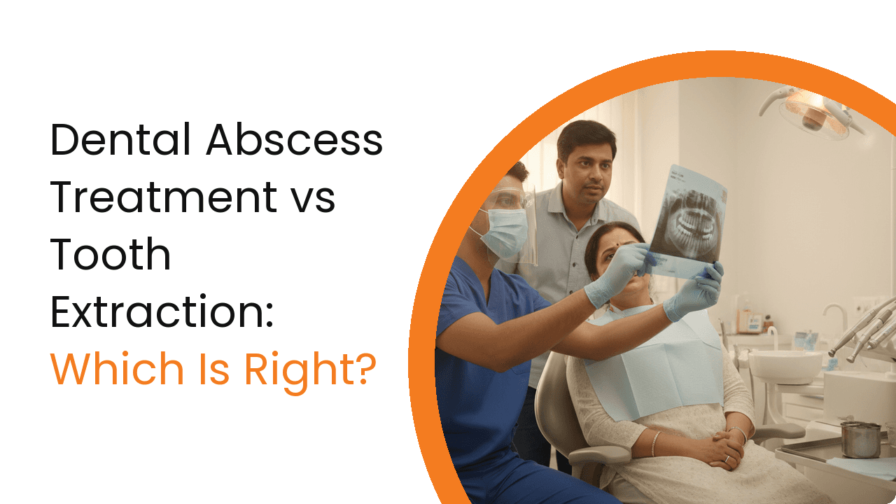 Dental Abscess Treatment Vs Tooth Extraction
