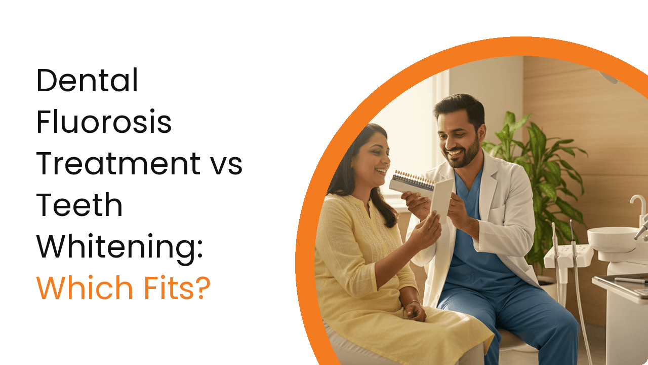 Dental Fluorosis Treatment Vs Teeth Whitening