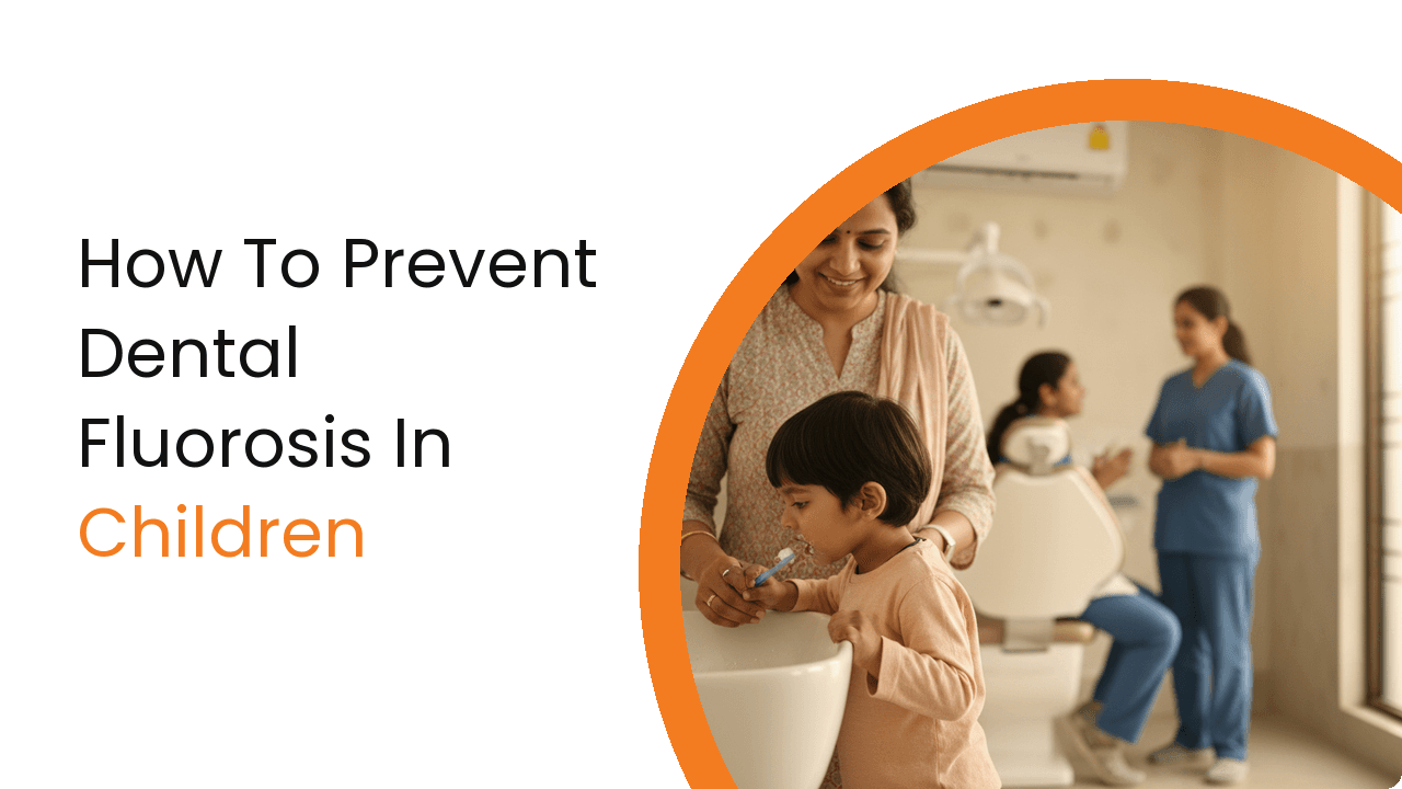How To Prevent Dental Fluorosis In Children
