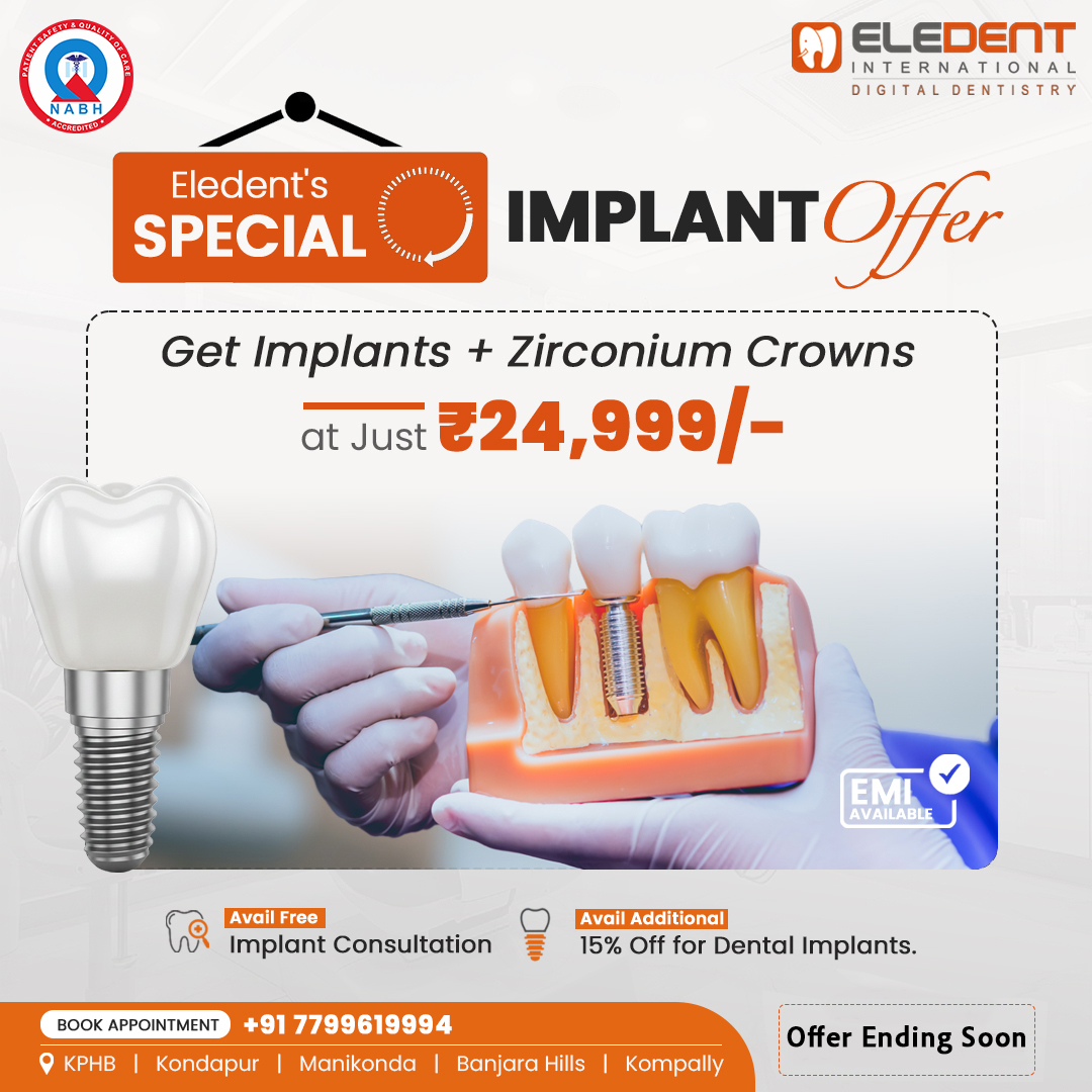 Implant Offer