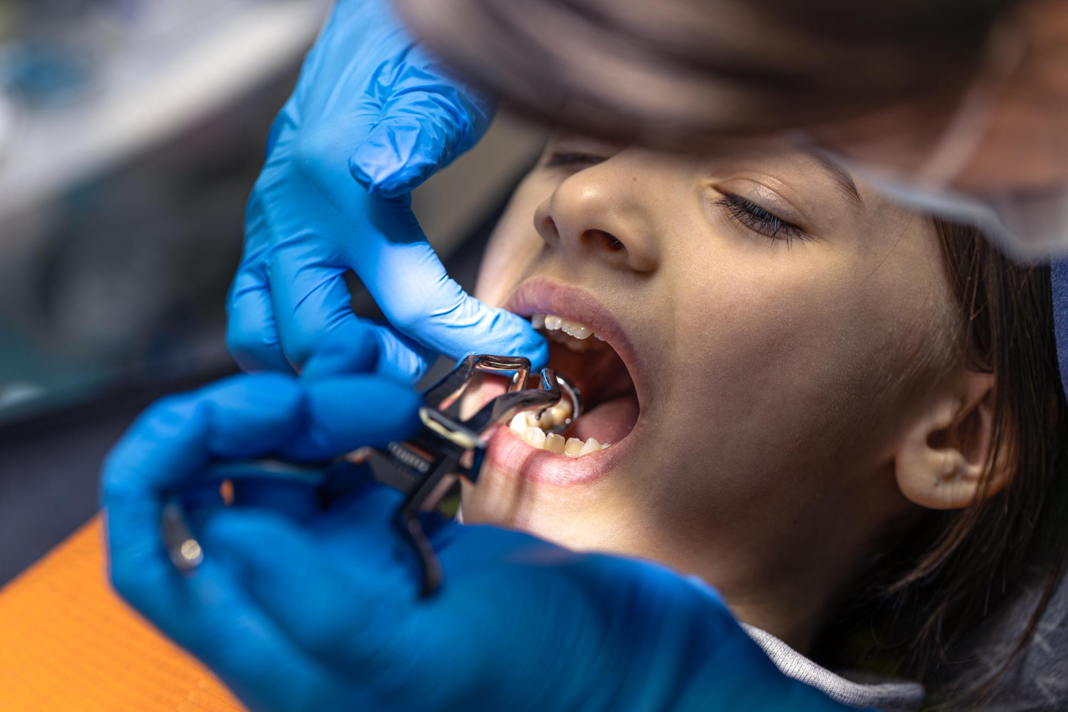 Paediatric Dentistry