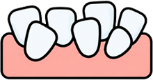 Crooked Adult Teeth Emerging