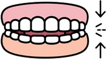 Difficulty Opening Your Mouth Fully