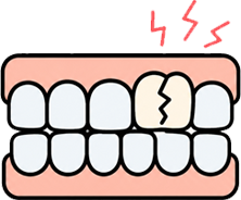 Severe Pain While Biting