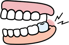 Sharp Pain Behind the Molars