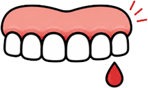 Swollen, Red, or Bleeding Gums
