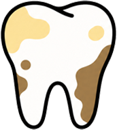 Yellow or Brown Discolouration