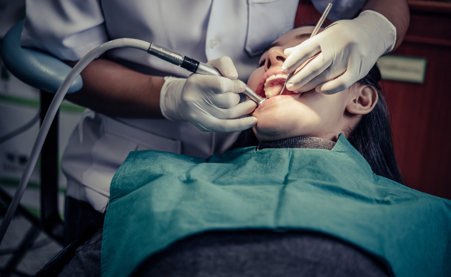 Wisdom Tooth Removal