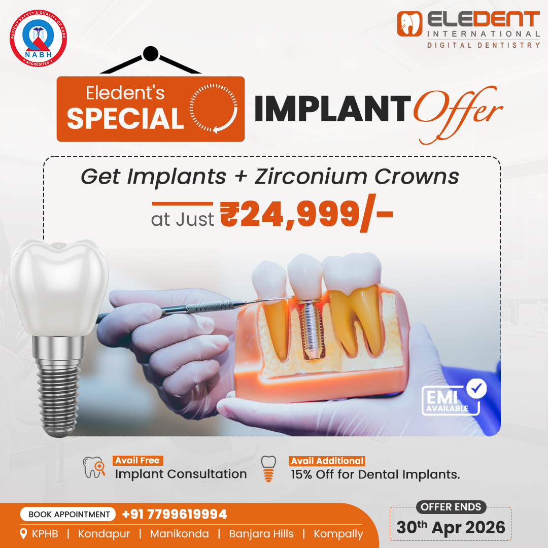 Implant Offer