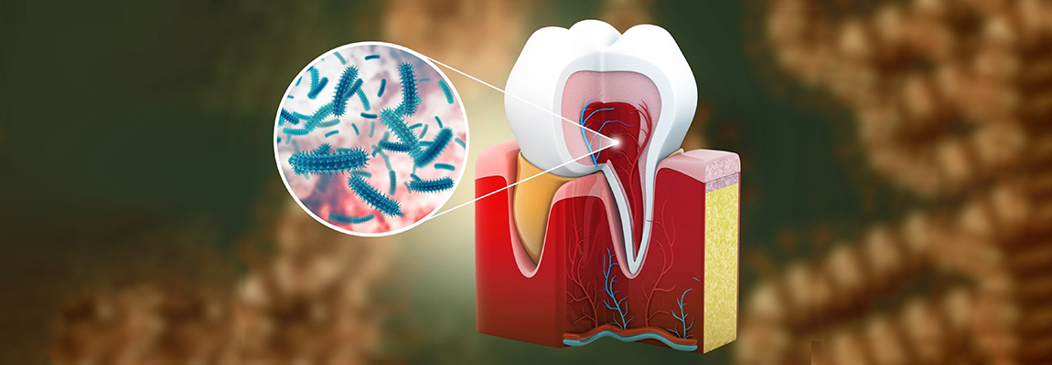 Guided Biofilm Therapy Gbt Eledent Dental Hospitals