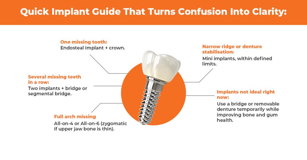 which implant is best for you