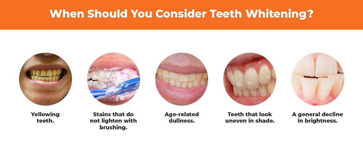 Best-Reasons-to-Have-Your-Teeth-Professionally-Whitened-info