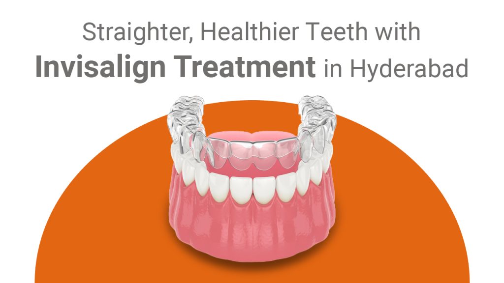 Benefits of Invisalign: Straighter and Healthier Teeth