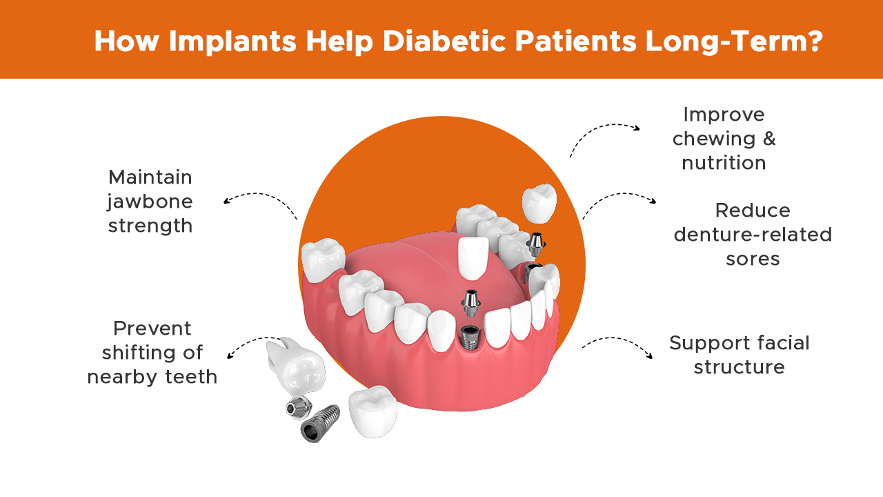 how-implants-help-diabetic-patients-long-term_info